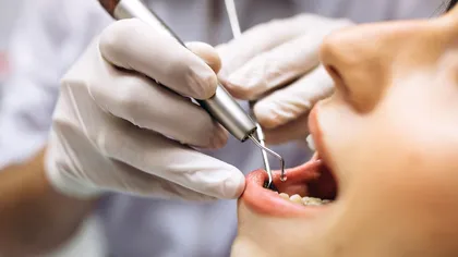 Serviciile stomatologice gratuite de care beneficiază românii neasiguraţi. Noul regulament anunţat de CNAS