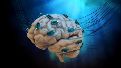 Implanturi cerebrale inovatoare ar putea revoluționa tratamentul pentru Parkinson