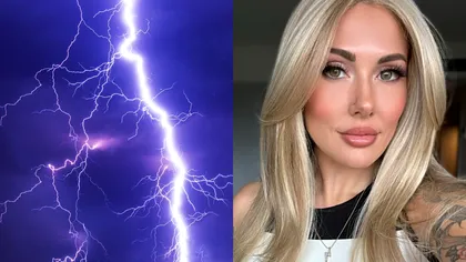 Lovită de un fulger, a fost paralizată ore întregi şi a rămas cu un ochi de culoare diferită. 