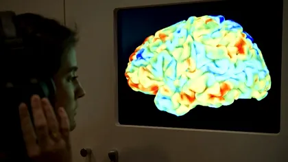 Implantul pe creier care transformă gândurile în vorbire aproape instant. Cum îi ajută pe cei cu paralizie să funcționeze în societate