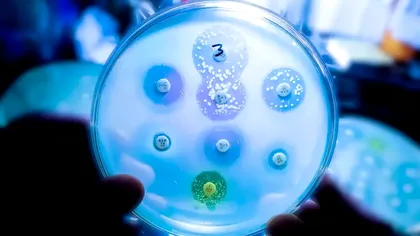 Superbacteria periculoasă care „mănâncă” plastic: Un nou pericol ascuns în spitale