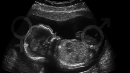 Descoperire: mediul extern poate schimba sexul unui mamifer, masculii pot deveni femele în timpul dezvoltării embrionare