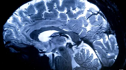 O nouă frontieră în imagistica cerebrală: Cercetătorii au reușit să trimită lumină prin întregul cap uman