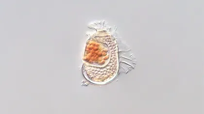 Microbul cu genom bizar de mic ar putea fi în curs de transformare într-un virus. Ce avertizează specialiștii