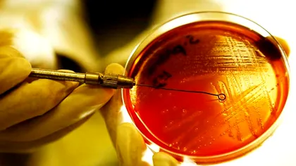 Inteligența artificială creează două antibiotice promițătoare împotriva gonoreei și bacteriei MRSA rezistente la antibiotice