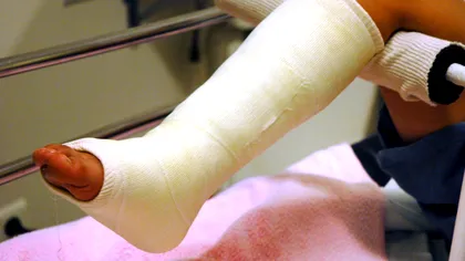 Cum au ajuns oamenii să-și rupă picioarele de bună voie și să sufere teribil de dragul standardelor de frumusețe. Cum câștigi câțiva centimetri în înălțime