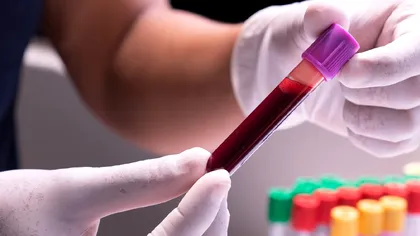 Test de sânge care ar putea depista peste 50 de tipuri de cancer din timp, arată un studiu revoluționar