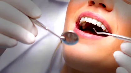 Gelul care repară smalțul dinților ar putea ajunge în cabinete chiar de anul viitor și îi entuziasmează pe cercetători