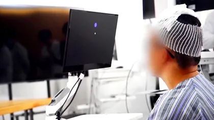 Bărbat paralizat își controlează scaunul cu rotile și gadgeturile doar cu mintea, la cinci zile după un implant cerebral în China
