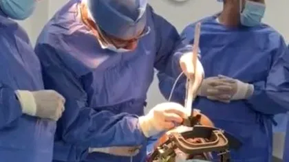 Operație spectaculoasă pentru Parkinson: pacientul era treaz când medicii i-au oprit tremurul