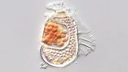 Microbul care împinge viața la limită revine cu o confirmare importantă. Are un genom incredibil de mic și aproape niciun metabolism