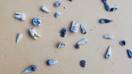 EXCLUSIV Explicațiile unui medic stomatolog despre dinții care ar fi fost descoperiți în casa groazei din Caracal