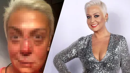 Ce s-a întâmplat cu Monica Anghel? Cântăreața a fost desfigurată la propriu. Cum a ajuns în această situație