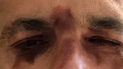 Mădălin Ionescu și-a șocat fanii pe Instagram. Ce a pățit la față vedeta tv: 