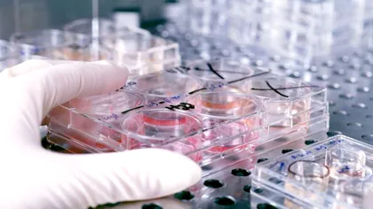 Cancerul s-ar putea vindeca fără tratament. Iată leacul care i-a uimit pe cercetători: ”Într-un timp atât de scurt!”