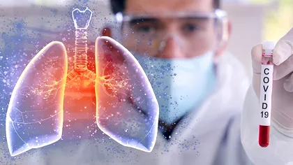 Cum arată plămânii unui pacient infectat cu coronavirus. Imaginile vorbesc de la sine