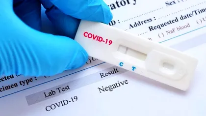 Cine sunt, de fapt, cei care fac testările în România. Ce mărturisesc ”oamenii cu eprubeta”