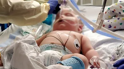 Dramă cumplită pentru un bebeluș. Un bărbat din Galați și-a torturat fiul cu sălbăticie dintr-un motiv înfiorător. Ce șanse îi dau medicii