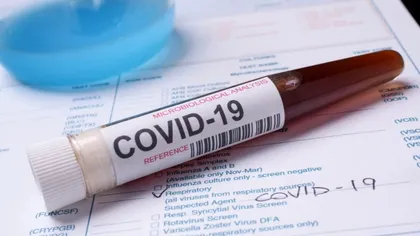 Atenție dacă ai aceste trei simptome! Ar putea fi coronavirus. Descoperirea specialiștilor