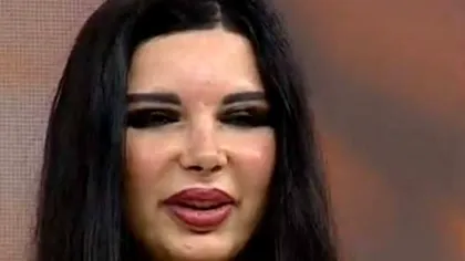Marinela Nițu este de nerecunoscut. Cum arată fosta iubită a lui Miron Cozma, din cauza operațiilor