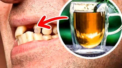 Cele mai dăunătoare alimente pentru dinți. Mare atenție la ce consumi