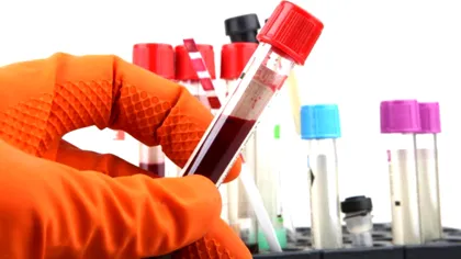 Ce români sunt cei mai rezistenți la infectarea cu covid. Ești mai norocos dacă ai grupa asta de sânge