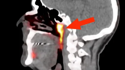 Organul misterios din centrul capului tuturor oamenilor. Ce cred cercetătorii că este, de fapt