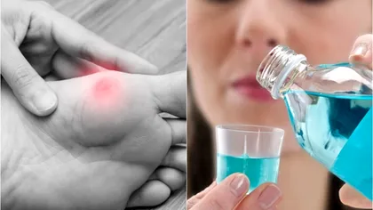 Pune apă de gură pe bătături. Leacurile din popor care fac minuni pentru sănătate