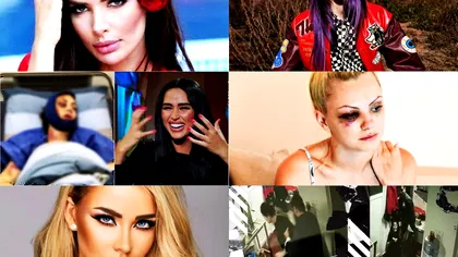 Top 8 vedete din România bătute de iubiții lor. Scene dramatice cu celebritățile arse cu țigara sau lovite cu bestialitate