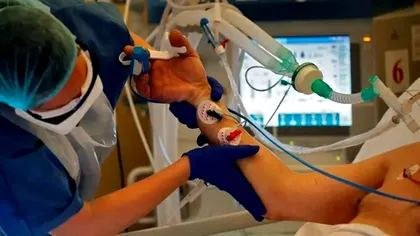 OMS, avertisment îngrijorător pentru omenire. Ce se întâmplă, de fapt, cu imunitatea unui pacient care a fost infectat cu COVID-19