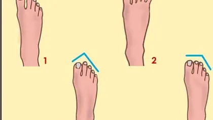 Ce spune lungimea degetelor de la picioare despre tine. Secretele tale sunt date de gol