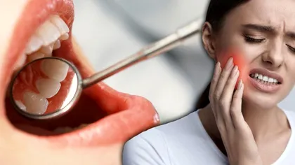 Ce dinte doare? Așa îți dai seama imediat ce afecțiune ai: cât de simplu e