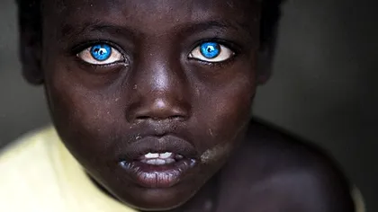 Ce se întâmplă cu oamenii care au ochii albaștri. Pericolul neștiut de care trebuie să se ferească