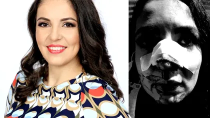 Cristina Joia, operată din nou la nas. Ce se întâmplă cu vedeta PRO TV, trăiește o mare dramă