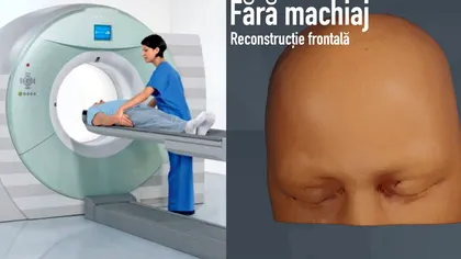 Ce se întâmplă dacă mergi machiată la RMN. Un medic publică imagini șocante