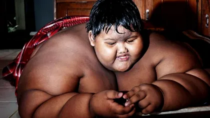 Cum arată acum cel mai gras copil din lume. A slăbit peste 100 de kilograme, este de nerecunoscut