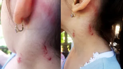 Caz cutremurător la o grădiniță privată din București. Fetiță de trei ani, strânsă de gât de educatoare. Ce arată rezultatele expertizei medico-legale