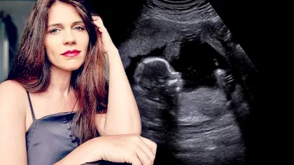 Aida Parascan a recunoscut acum. Ce lucru crunt i-a spus iubitul ei înainte să piardă sarcina