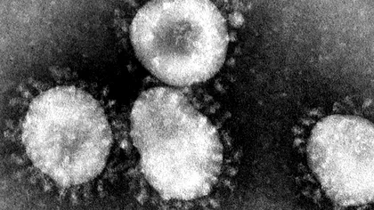 MERS-CoV, noul virus care amenință omenirea. Care sunt simptomele lui