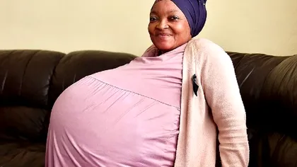 Femeia care a uluit lumea medicală. Ce a născut, de fapt, deși la ecografie ginecologul a văzut altceva