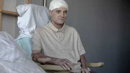 Medicul erou, ars în incendiul de la Piatra Neamț, umilit de Ministerul Sănătății la revenirea în țară. Ce nu are voie să facă