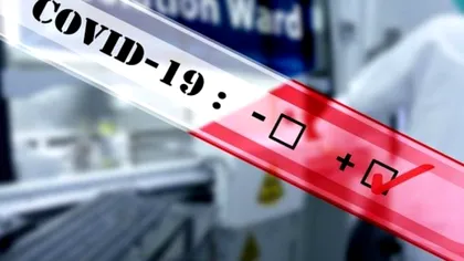 Cât de des se pot reinfecta cu covid persoanele nevaccinate, de fapt. Descoperirea cercetătorilor