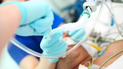 Cât de afectați sunt plămânii celor nevaccinați, dar bolnavi de covid-19. Medicii oferă detalii