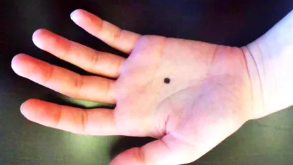 Ai alunițe în palmă? Care este semnificația lor, în funcție de locul unde apar