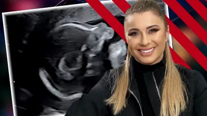 Anamaria Prodan nu s-a putut abține. Ce a spus când a văzut ecografia bebelușului lui Reghecampf