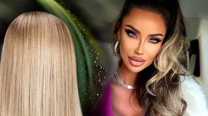 De ce a apărut Bianca Drăgușanu plină de vânătăi. Ce a pățit vedeta, de fapt