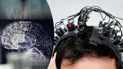 Un bărbat a murit în timpul unui EEG. Ce imagini a dezvăluit creierul lui i-a uluit total pe medici VIDEO