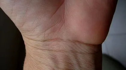 Ce înseamnă liniile de la încheietura mâinii. Așa poți afla dacă vei avea o viață lungă