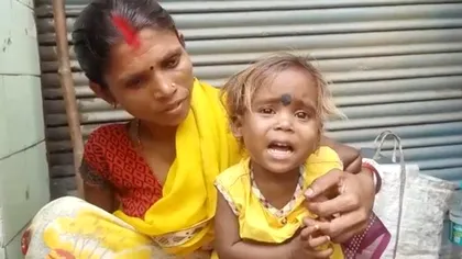 Cum arată „fetița păianjen” care s-a născut cu 4 brațe. Ce spun medicii din India despre cazul ei VIDEO