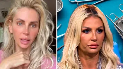 Adevărul despre operațiile estetice ale Andreei Bănică. Artista s-a enervat